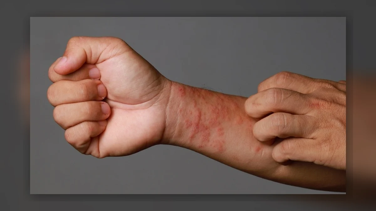 Protecting Your Hands and Skin on Site: What UK Tradespeople Need to Know